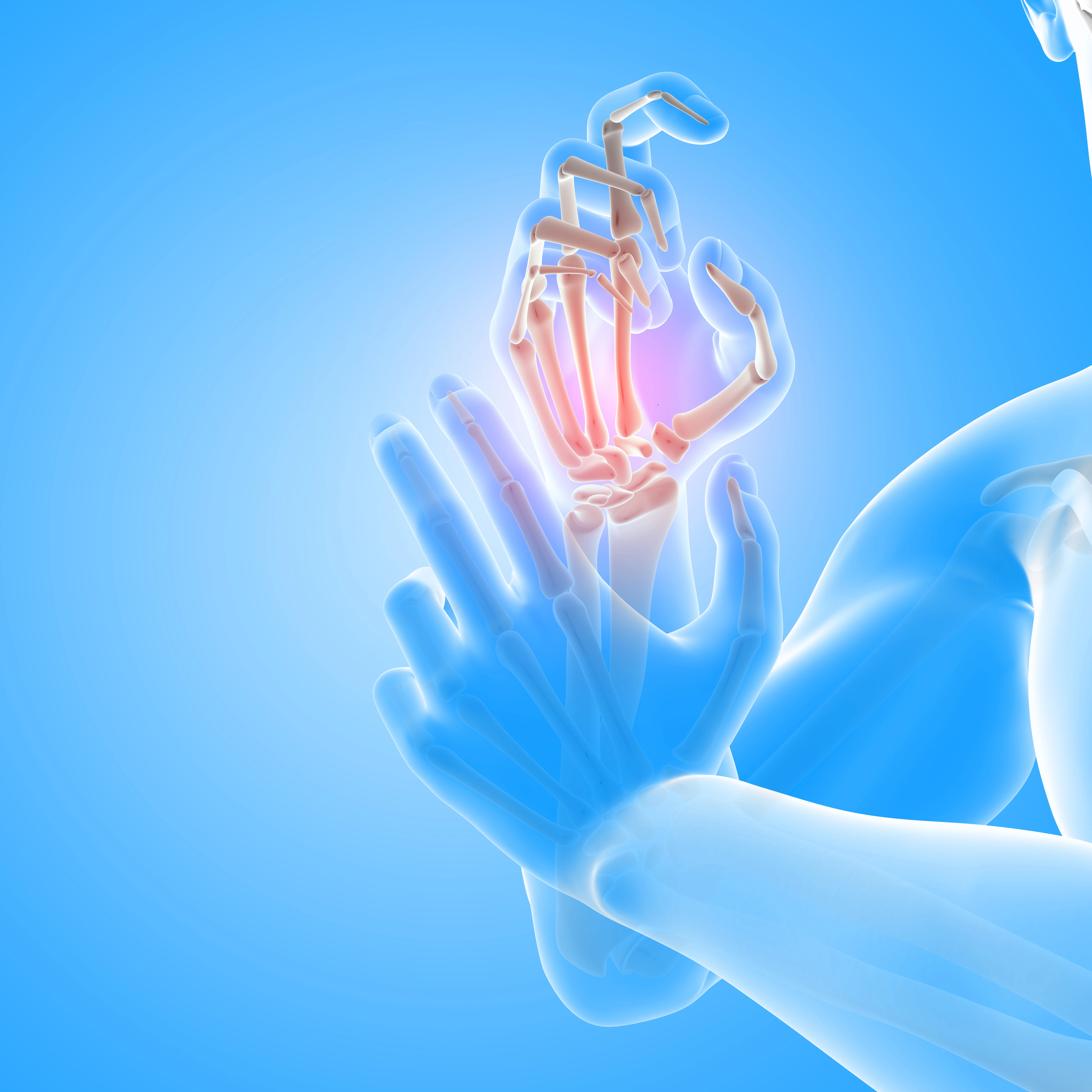 5 Early Signs of Joint Problems You Shouldn’t Ignore